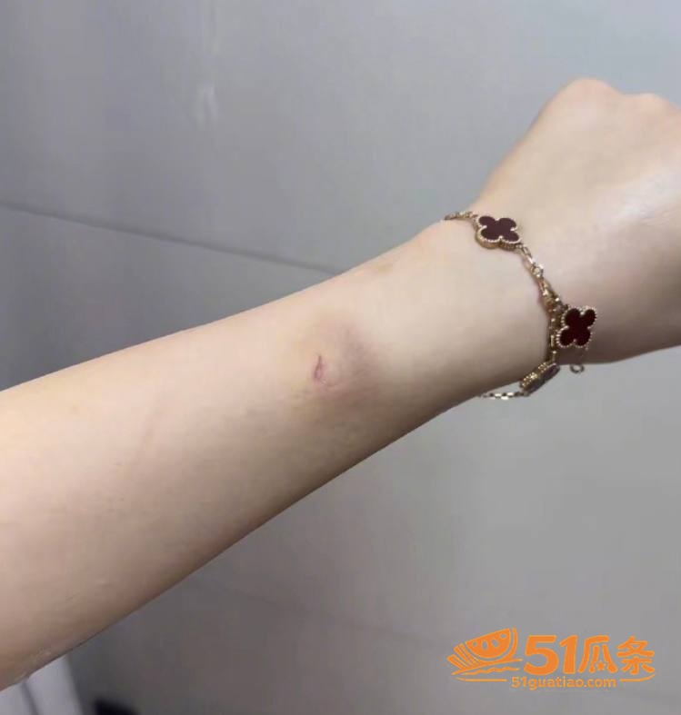 王垲智 纯情北极兔人相关图片45