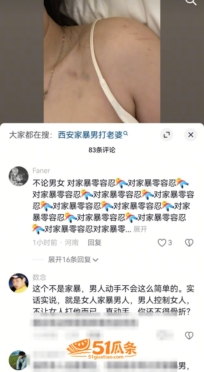 家暴出轨 雷秦俊 出相关图片2