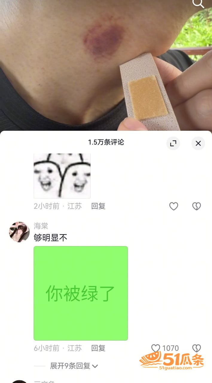 出轨爆料 BigSe相关图片25