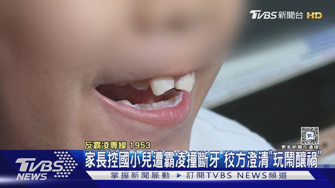 9岁孩子课间撞断门牙 学校不赔偿