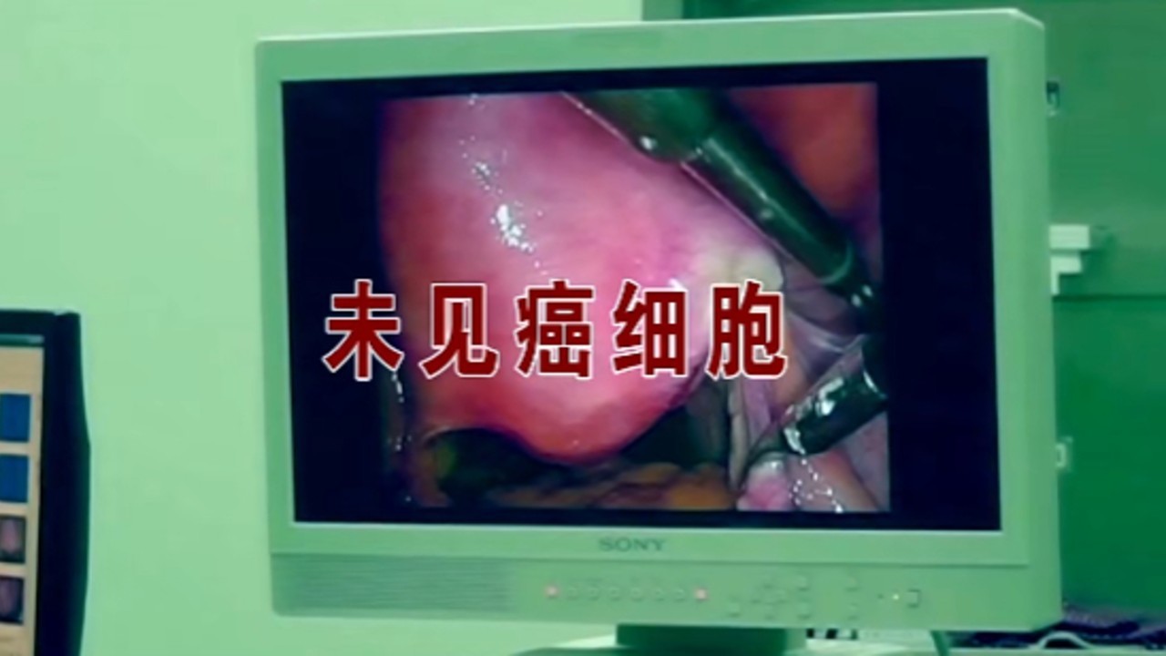 男子被医院误诊胃癌切全胃 获赔22万