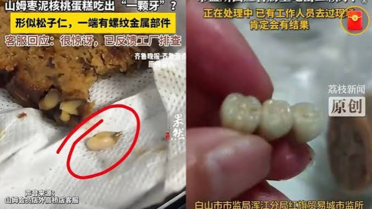 广州酒家烧卖中吃出类似牙齿异物
